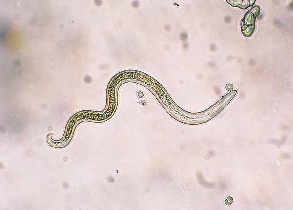Toxocara canis (roundworms) second stage larvae hatch from eggs in microscope. Toxocariasis, also known as Roundworm Infection, causes disease in humans